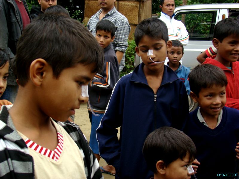 Irom Sharmila 12 years of fast: Children depicts forceful nose feeding of Irom Chanu Sharmila at Sangaithel :: Nov 4 2012